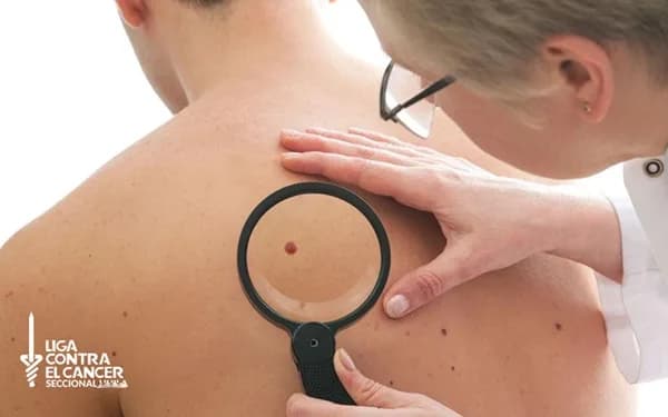 Colombia registra 62.000 casos nuevos de cáncer en un año y la proyección alerta un aumento del 30 % hacia 2030